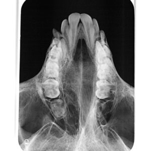 Folie, dentales Speicherfoliengeräte